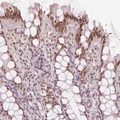 Anti-HDAC1 antibody produced in rabbit Prestige Antibodies&#174; Powered by Atlas Antibodies, affinity isolated antibody, buffered aqueous glycerol solution