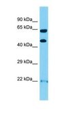 Anti-OPRK1 antibody produced in rabbit affinity isolated antibody