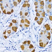 Anti-POLB antibody produced in rabbit