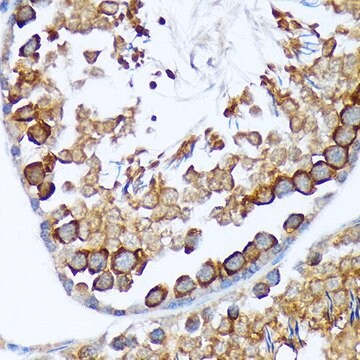 Anti-TACC3 antibody produced in rabbit