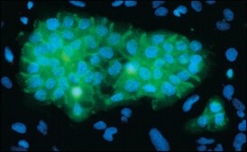 Monoclonal Anti-Epidermal Growth Factor Receptor antibody produced in mouse clone 29.1, ascites fluid