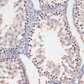 Anti-Phospho-GSK3B-S9 antibody produced in rabbit