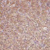Anti-SOAT1 antibody produced in rabbit Prestige Antibodies&#174; Powered by Atlas Antibodies, affinity isolated antibody, buffered aqueous glycerol solution