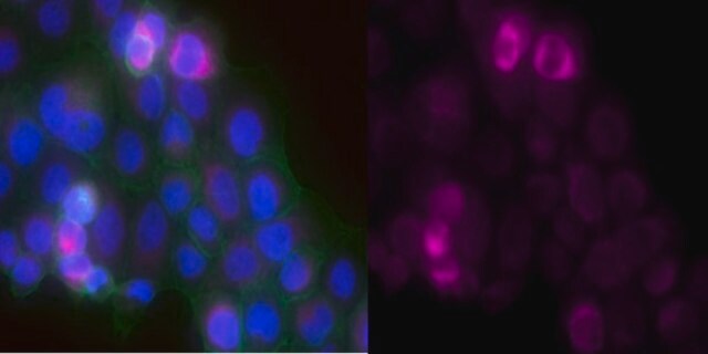 Anti-Laminin-5 Antibody (&#947;2 chain), clone D4B5, Alexa Fluor&#8482; 647 Conjugate clone D4B5, from mouse, ALEXA FLUOR&#8482; 647