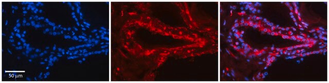 Anti-TSHR affinity isolated antibody