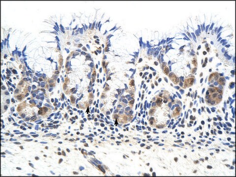 Anti-PRKRA antibody produced in rabbit affinity isolated antibody