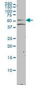 Monoclonal Anti-NR1H2 antibody produced in mouse clone 2H2-H3, purified immunoglobulin, buffered aqueous solution