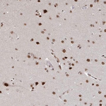 Anti-ZDHHC12 antibody produced in rabbit Prestige Antibodies&#174; Powered by Atlas Antibodies, affinity isolated antibody, buffered aqueous glycerol solution