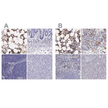 Anti-FCN1 antibody produced in rabbit Ab1, Prestige Antibodies&#174; Powered by Atlas Antibodies, affinity isolated antibody, buffered aqueous glycerol solution