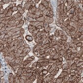 Monoclonal Anti-LAMB2 antibody produced in mouse Prestige Antibodies&#174; Powered by Atlas Antibodies, clone CL2976, purified immunoglobulin, buffered aqueous glycerol solution