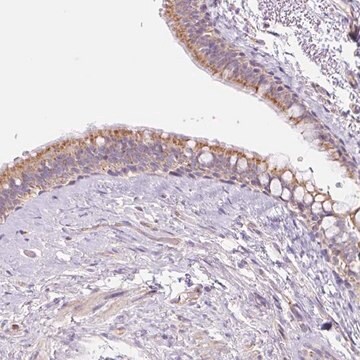 Anti-ESAM antibody produced in rabbit Prestige Antibodies&#174; Powered by Atlas Antibodies, affinity isolated antibody, buffered aqueous glycerol solution