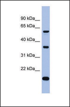 Anti-LARP6 antibody produced in rabbit affinity isolated antibody