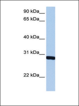 Anti-SMN1 antibody produced in rabbit affinity isolated antibody