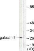 Anti-Galectin 3 antibody produced in rabbit affinity isolated antibody