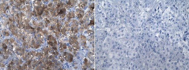 Anti-SLC18A1 Antibody, clone 1J12 ZooMAb&#174; Rabbit Monoclonal recombinant, expressed in HEK 293 cells