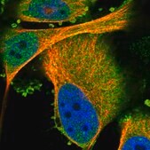 Anti-PRKCH antibody produced in rabbit Prestige Antibodies&#174; Powered by Atlas Antibodies, affinity isolated antibody, buffered aqueous glycerol solution