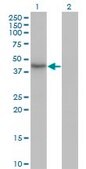 Monoclonal Anti-HDAC11 antibody produced in mouse clone 1C2-2G5, purified immunoglobulin, buffered aqueous solution