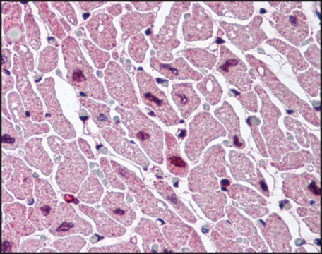 Anti-CYSLT2 (AB2) antibody produced in rabbit affinity isolated antibody, buffered aqueous solution