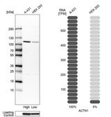 Anti-ACTN1 antibody produced in rabbit Prestige Antibodies&#174; Powered by Atlas Antibodies, affinity isolated antibody, buffered aqueous glycerol solution