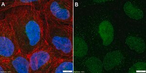 Anti-KEAP1 Antibody, clone 3B9 ZooMAb&#174; Rabbit Monoclonal recombinant, expressed in HEK 293 cells