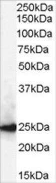 Anti-CBX1/HP1-&#946; antibody produced in goat affinity isolated antibody, buffered aqueous solution