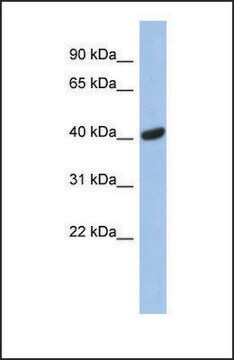 Anti-SIAH2 antibody produced in rabbit affinity isolated antibody