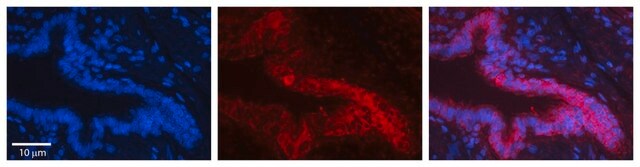 Anti-PSMA1 antibody produced in rabbit affinity isolated antibody