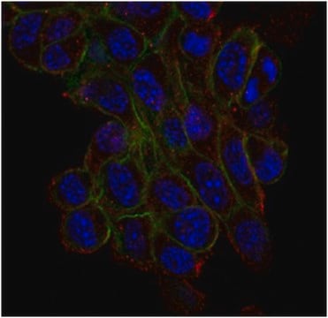 Anti-Trpv4 Antibody, clone 1B2.6 clone 1B2.6, from mouse