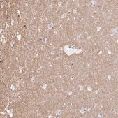 Anti-KCNQ2 antibody produced in rabbit Prestige Antibodies&#174; Powered by Atlas Antibodies, affinity isolated antibody, buffered aqueous glycerol solution