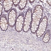 Anti-ZBBX antibody produced in rabbit Prestige Antibodies&#174; Powered by Atlas Antibodies, affinity isolated antibody, buffered aqueous glycerol solution