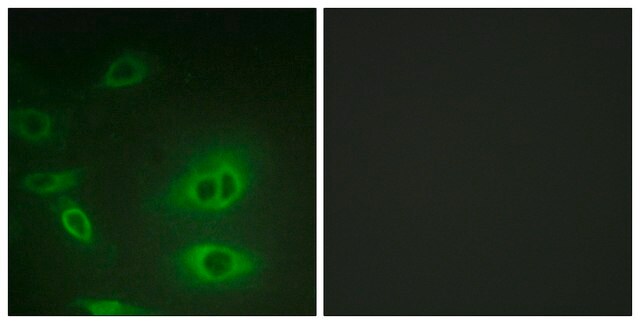 Anti-ATP1 &#945; antibody produced in rabbit affinity isolated antibody