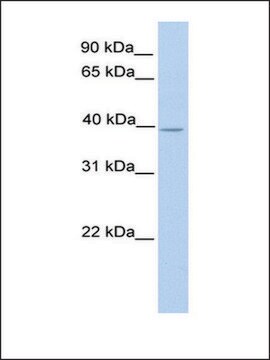 Anti-NEK6 antibody produced in rabbit affinity isolated antibody