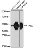 Anti-ATP1B1 antibody produced in rabbit