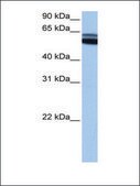 Anti-RARB antibody produced in rabbit affinity isolated antibody