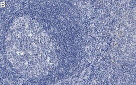Anti-Ki-67 Antibody, clone Ki-S5 ZooMAb&#174; Mouse Monoclonal recombinant, expressed in HEK 293 cells
