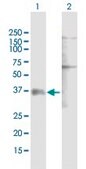 Anti-P2RY1 antibody produced in mouse purified immunoglobulin, buffered aqueous solution