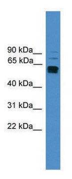 Anti-LAG3 (C-terminal) antibody produced in rabbit affinity isolated antibody