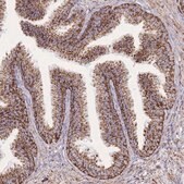 Anti-GSTM1 antibody produced in rabbit Prestige Antibodies&#174; Powered by Atlas Antibodies, affinity isolated antibody, buffered aqueous glycerol solution