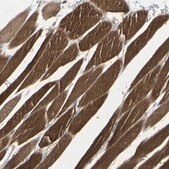 Anti-CACNA2D1 antibody produced in rabbit affinity isolated antibody, buffered aqueous glycerol solution