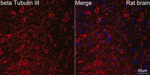 Anti-&#946;III-Tubulin Antibody, clone 6X6H6, Rabbit Monoclonal
