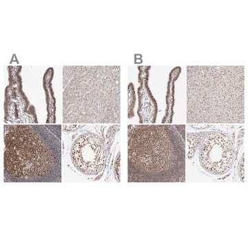 Anti-MSH6 antibody produced in rabbit Prestige Antibodies&#174; Powered by Atlas Antibodies, affinity isolated antibody, buffered aqueous glycerol solution, ab1