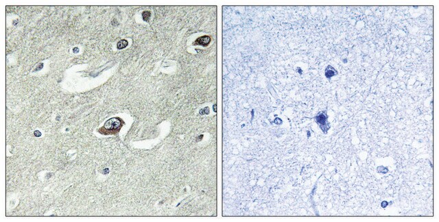 Anti-KIF20A antibody produced in rabbit affinity isolated antibody