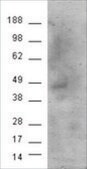 Anti-Cannabinoid receptor 1 antibody produced in goat affinity isolated antibody, buffered aqueous solution