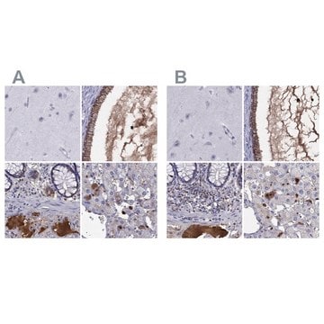 Anti-SERPINA3 antibody produced in rabbit Prestige Antibodies&#174; Powered by Atlas Antibodies, affinity isolated antibody, buffered aqueous glycerol solution