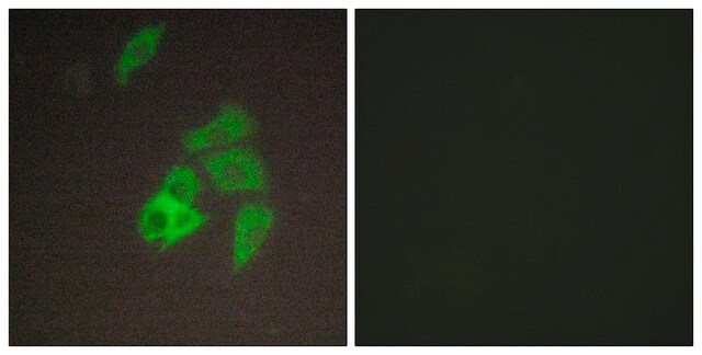 Anti-ST14, N-Terminal antibody produced in rabbit affinity isolated antibody