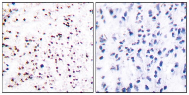 Anti-MCM5 antibody produced in rabbit affinity isolated antibody