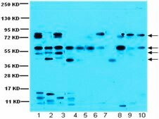 Anti-CaM Kinase II Antibody from rabbit, purified by affinity chromatography
