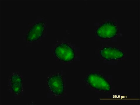 Anti-EXOSC3 antibody produced in mouse purified immunoglobulin, buffered aqueous solution