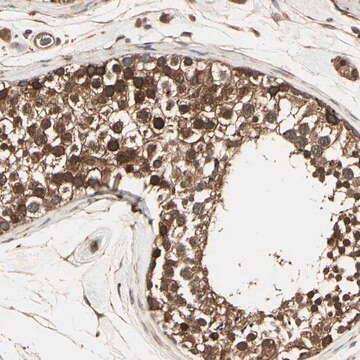 Anti-RNF14 antibody produced in rabbit Prestige Antibodies&#174; Powered by Atlas Antibodies, affinity isolated antibody, buffered aqueous glycerol solution