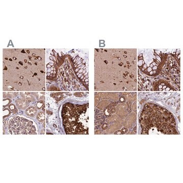 Anti-KARS antibody produced in rabbit Prestige Antibodies&#174; Powered by Atlas Antibodies, affinity isolated antibody, buffered aqueous glycerol solution